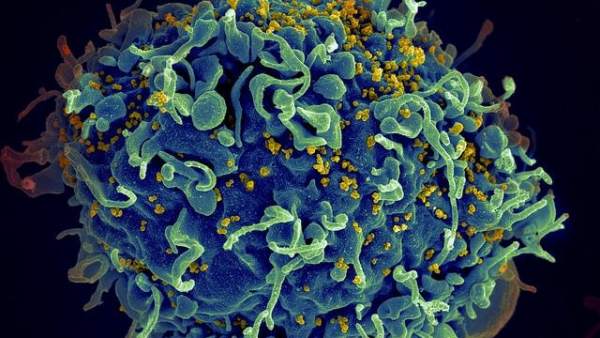 Descubren “super” receptor que ayuda a matar las células infectadas por el VIH