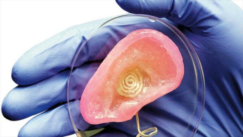 Médicos inventan una oreja gracias a la impresión 3D