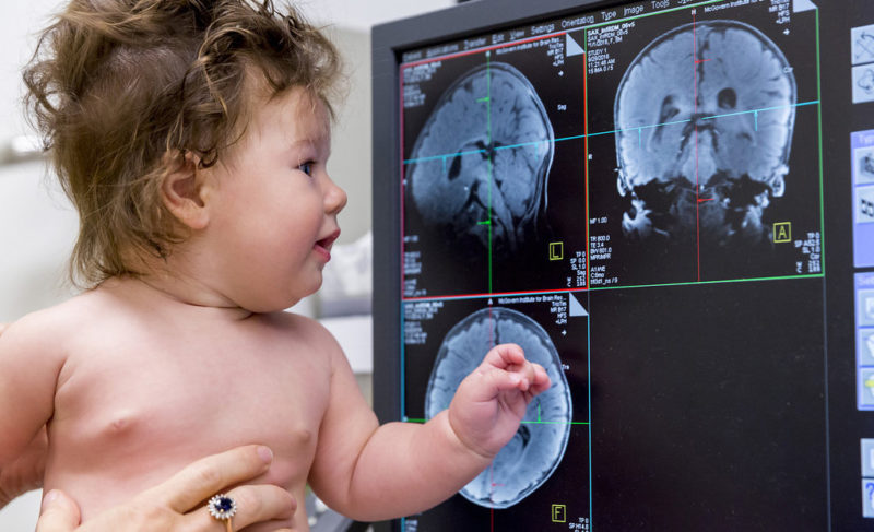 Cerebros de bebés,  las “computadoras” más inteligentes que existen, según uno de los mayores expertos en neurociencia