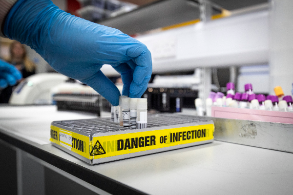 Laboratorio de California consigue autorización para distribuir prueba que detecta el coronavirus en 45 minutos