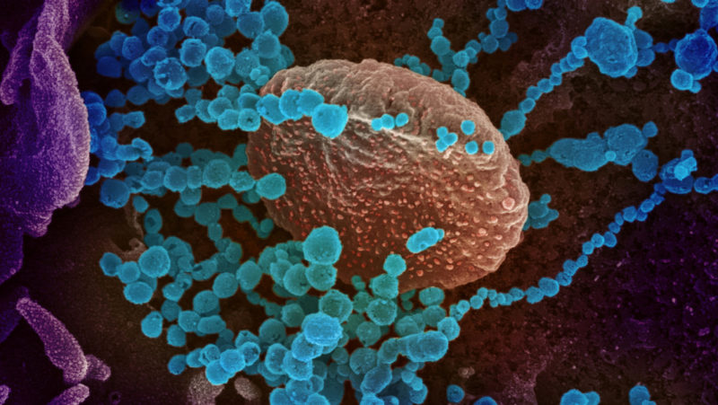 Científicos revelan “una de las cosas más extrañas del nuevo coronavirus”
