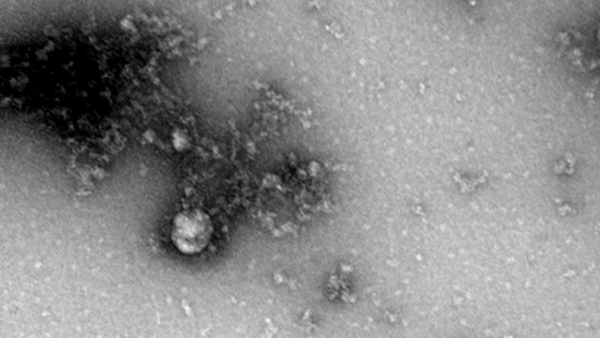 Video: Científicos rusos fotografían por primera vez la cepa británica del coronavirus