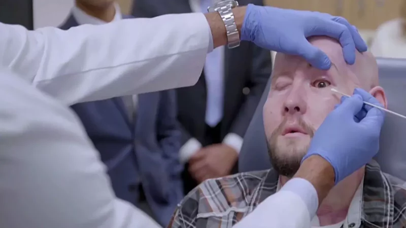 Primer trasplante de ojo entero en el mundo, en Nueva York